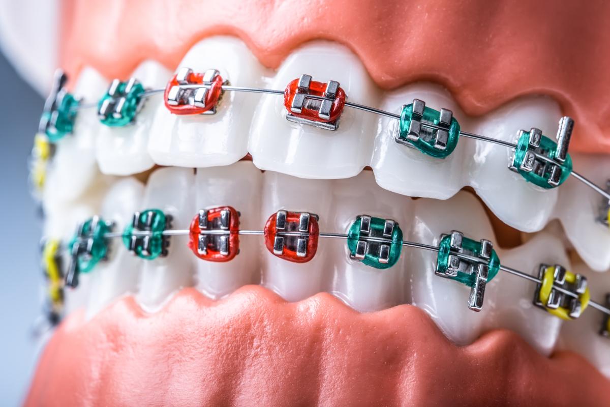 Orthodontie