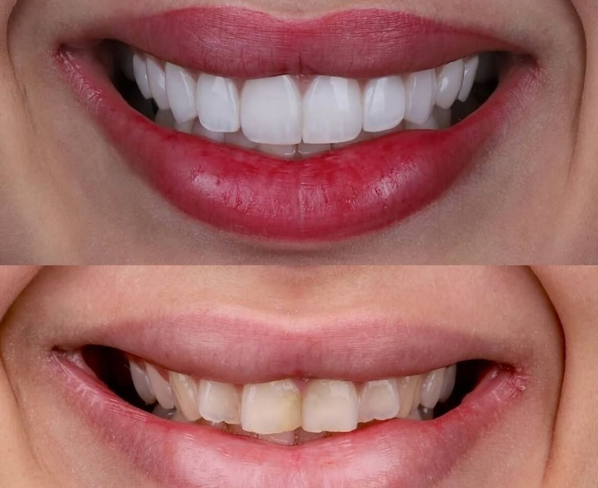 WhatsApp Image 2025-09-17 at 22.00.50